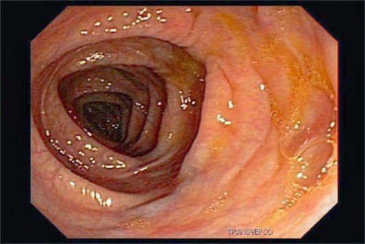 https://img.comunidades.net/aco/acoli-digital/limpeza_do_intestino.jpg