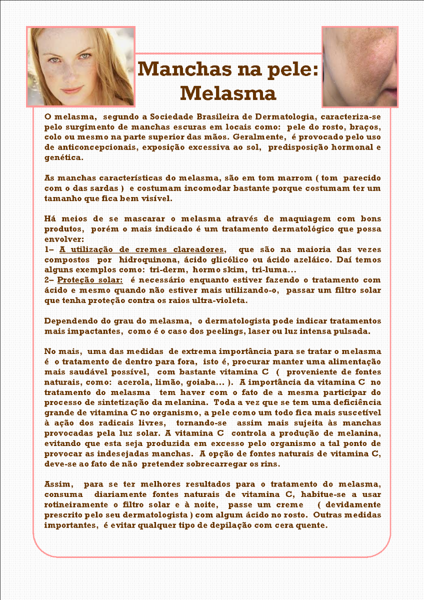 https://img.comunidades.net/aco/acoli-digital/melasma.png