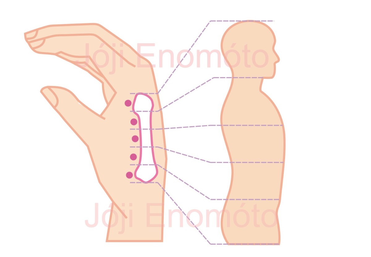 acupuntura do 2º Metacarpo Método Enomóto