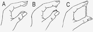 Muco Cervical