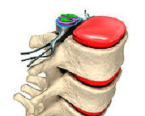 imagem vertebral saudavel