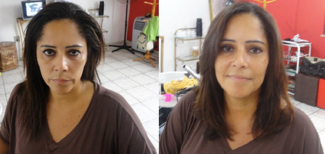 ANTES E DEPOIS