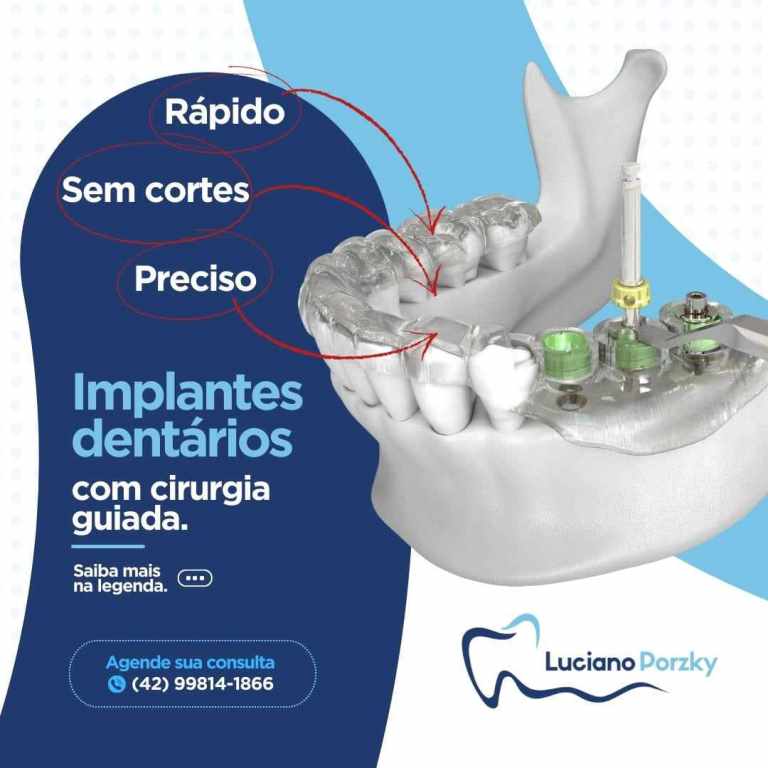 A Voz de Ibaiti e Região  IBAITI: MOCHON Moto Peças Acessórios e Oficina  inaugura sua loja na cidade