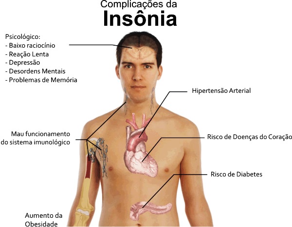 insonia