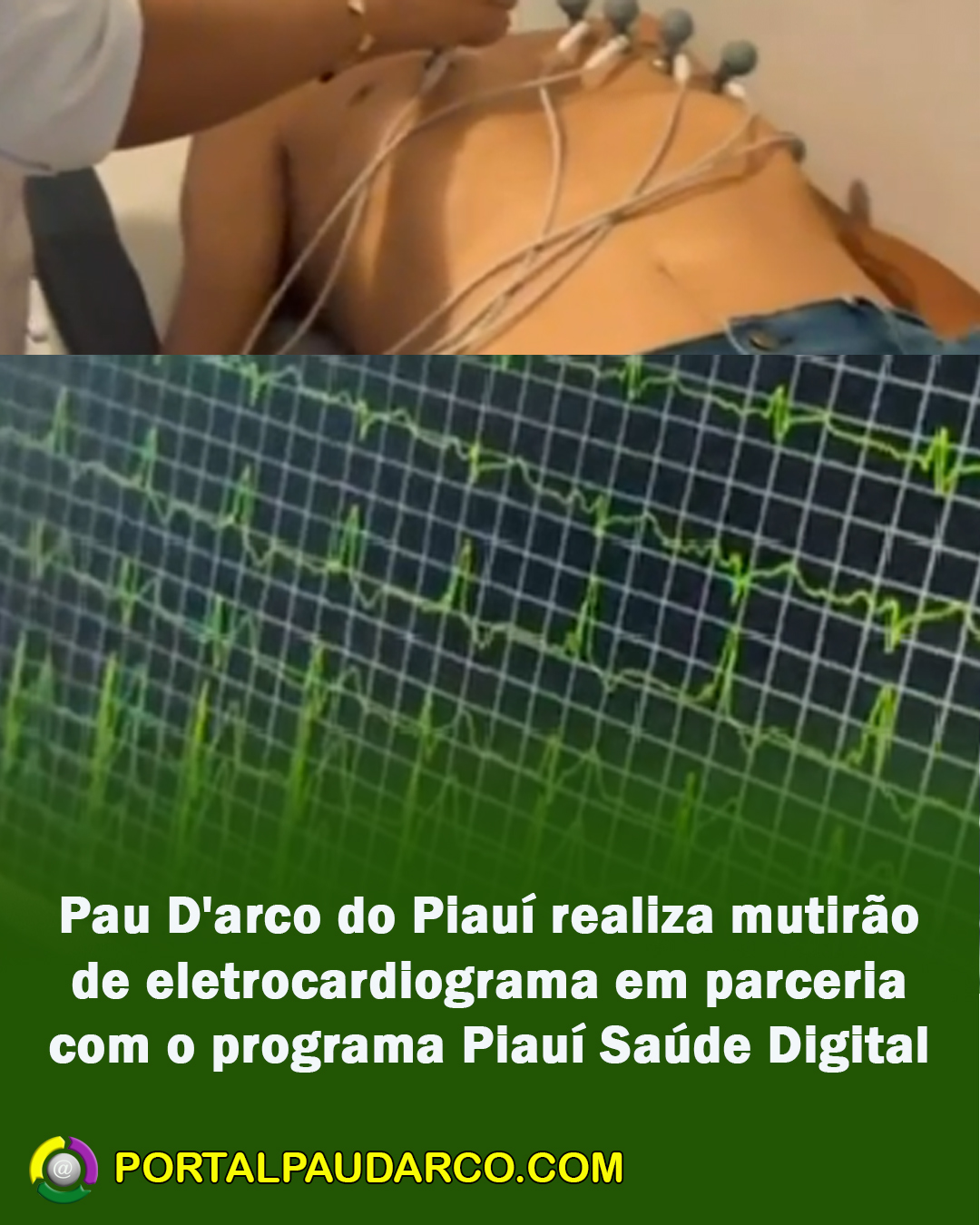 Pau D'arco do Piauí realiza mutirão de eletrocardiograma em parceria com o programa Piauí Saúde Digital
