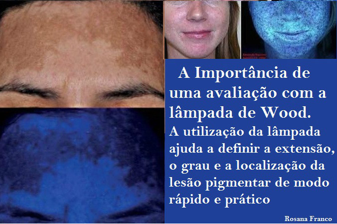 avaliação facial