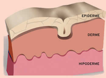 Epiderme