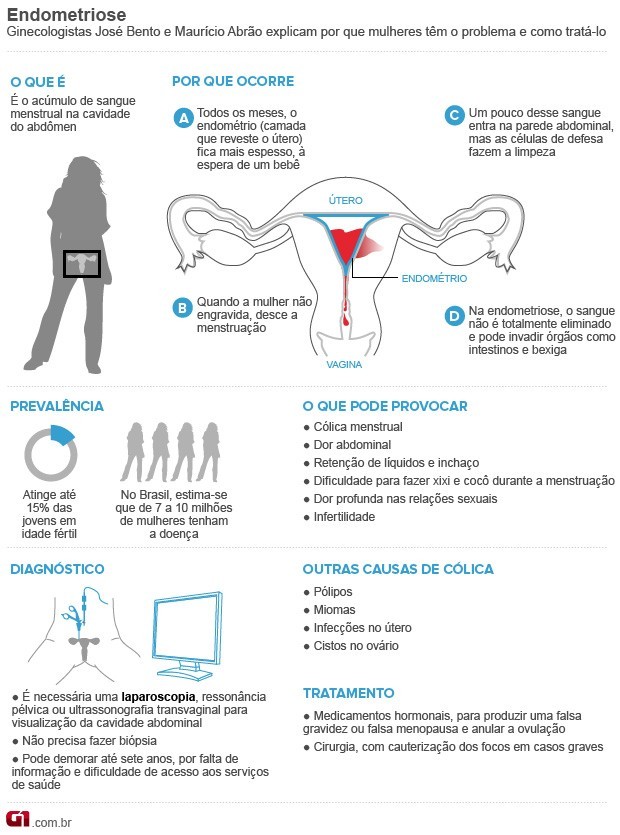 Endometriose