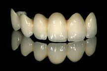 zirconia